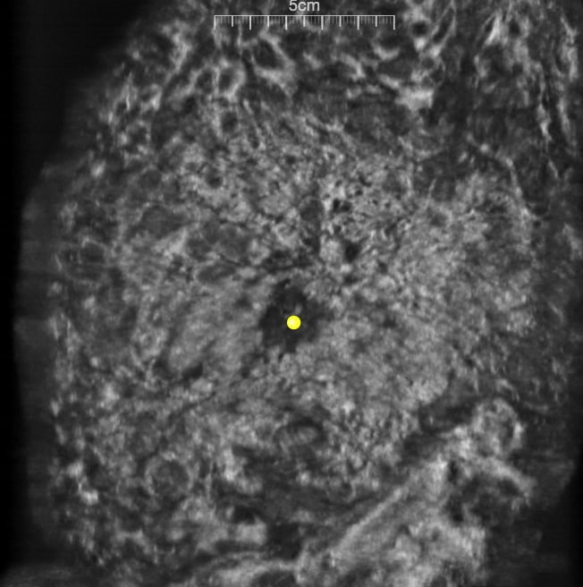 PathoVision 3D Solution